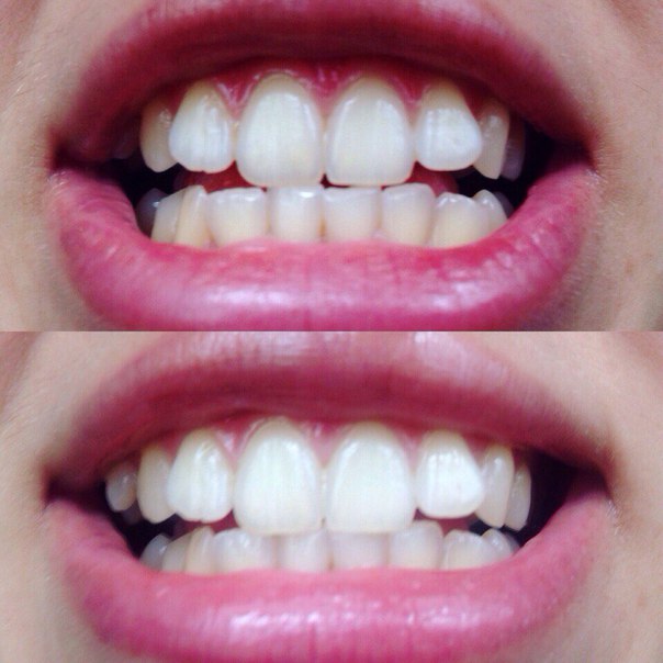 White&Smile
