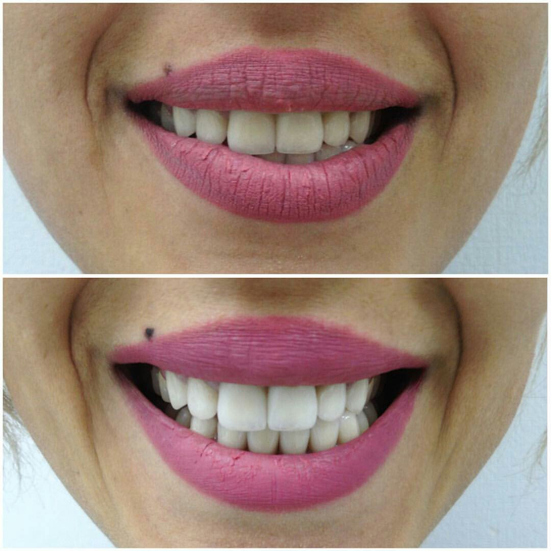White&Smile Novosibirsk