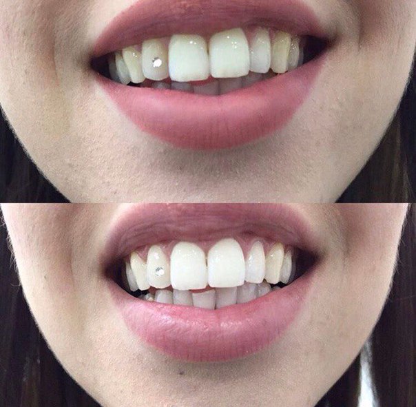White&Smile