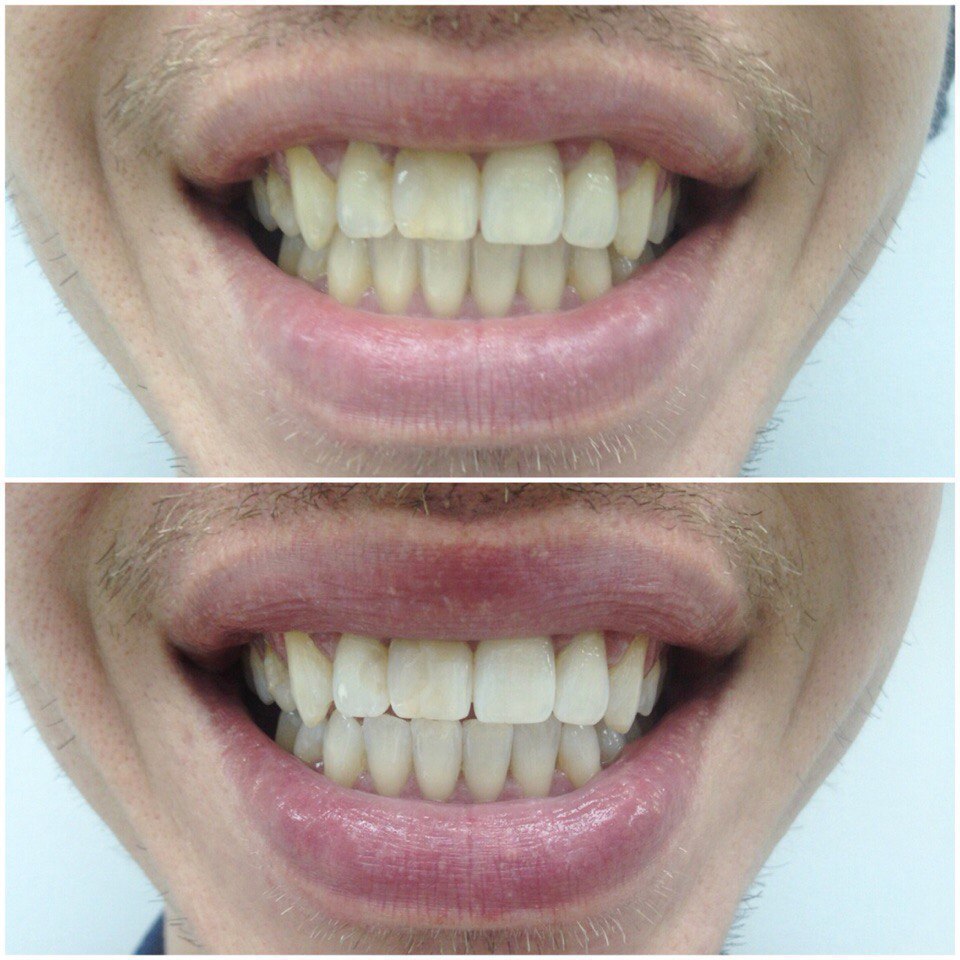 White&Smile Novosibirsk