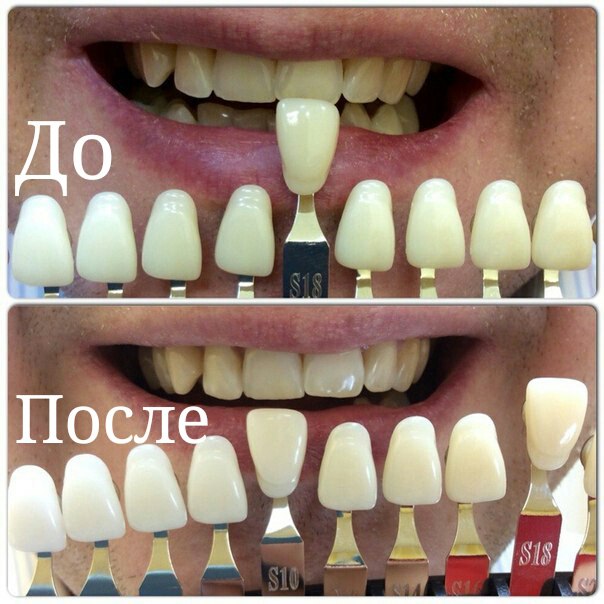 White&Smile Novosibirsk