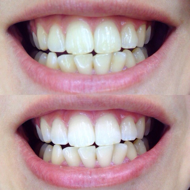 White&Smile