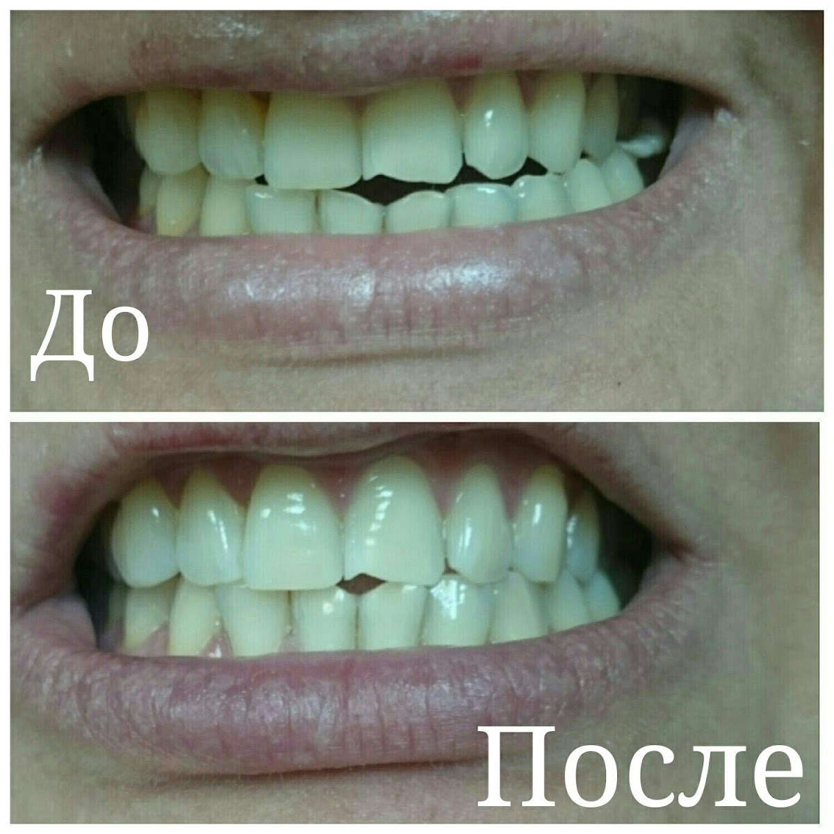 White&Smile Novosibirsk
