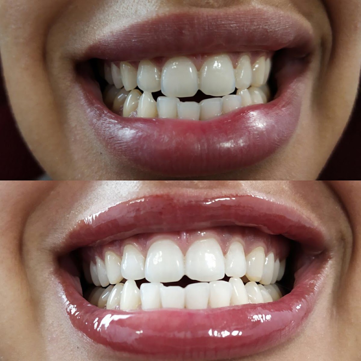 White&Smile