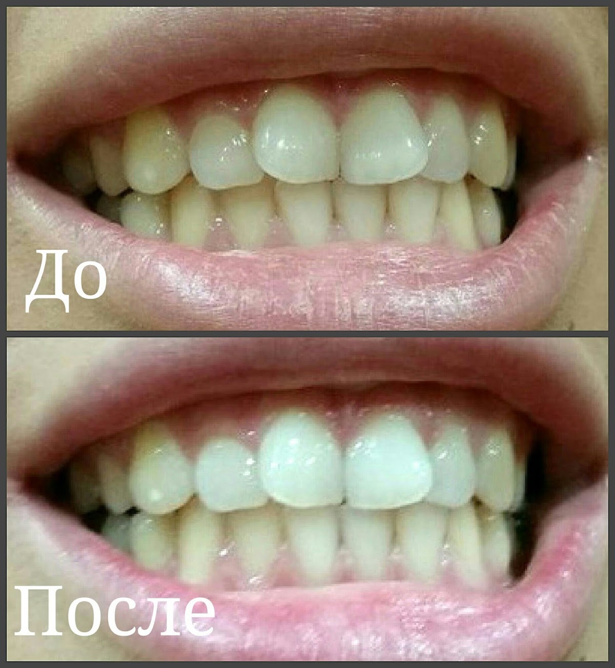 White&Smile Novosibirsk